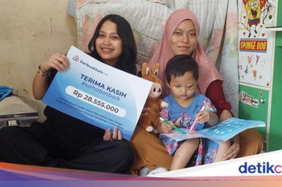 Sahabat Baik Bantu Kesembuhan Arumi, Balita Penderita Tumor Mata